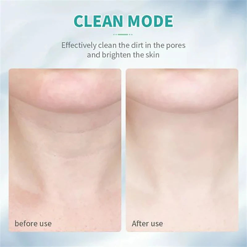 7-Color LED Neck & Face EMS Lifting Wand – Anti-Wrinkle