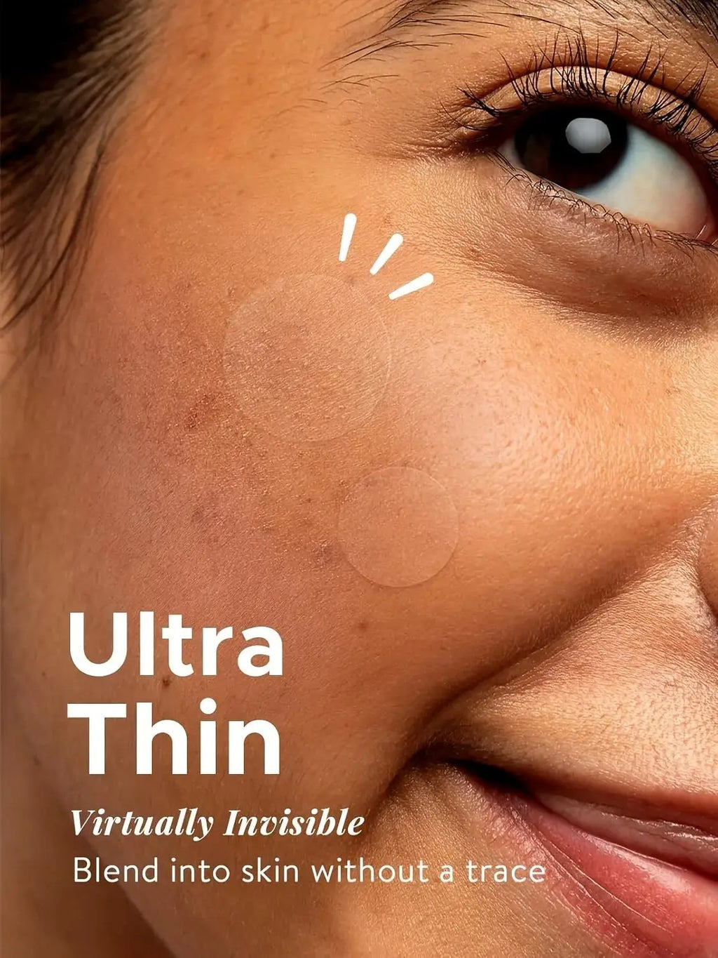 360pc Hydrocolloid Pimple Patches – Invisible Acne Spot Stickers