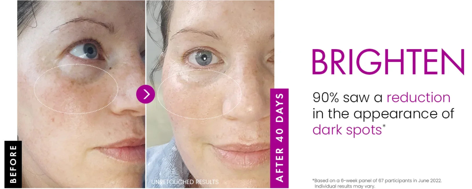 Korean Collagen Plumping Face Cream – Day & Night Moisturizer
