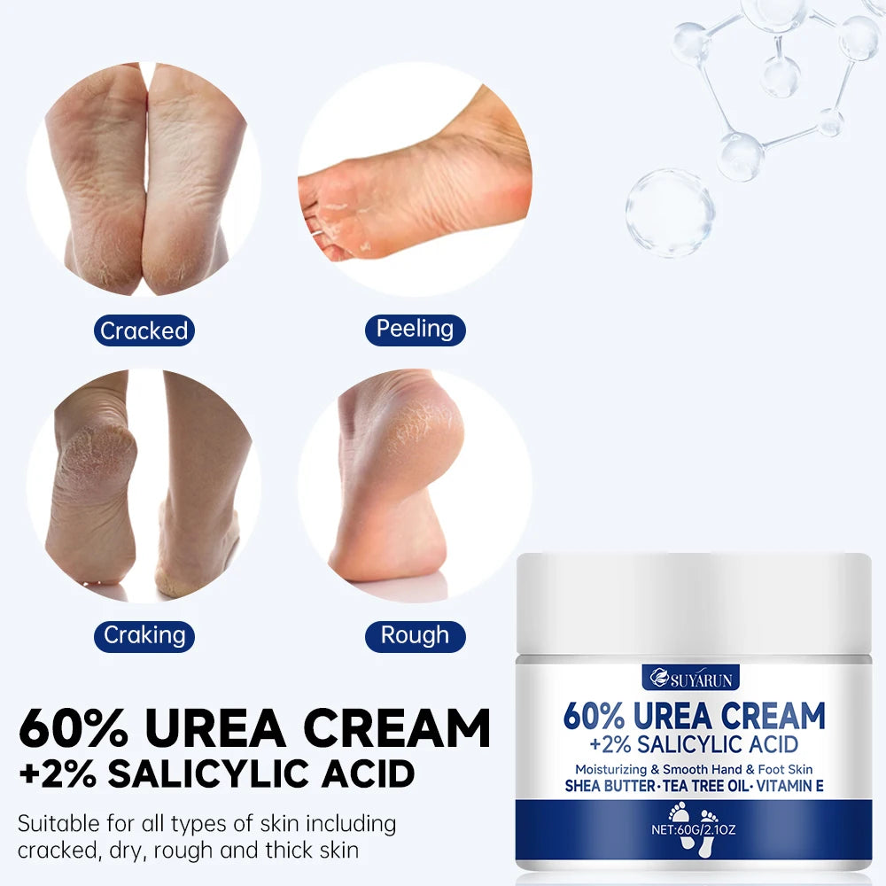 SUYARUN 60% Urea Foot Cream – Cracked Heels & Dry Skin Relief
