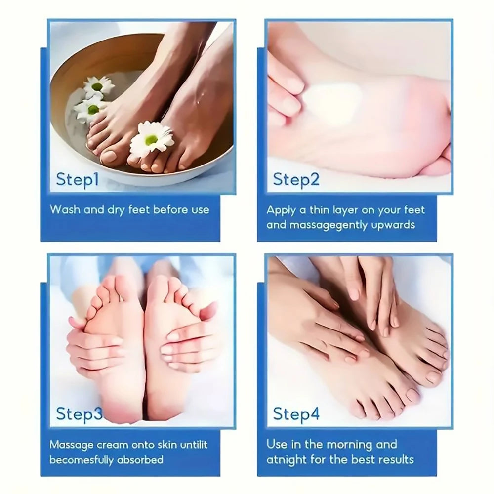SUYARUN 60% Urea Foot Cream – Cracked Heels & Dry Skin Relief