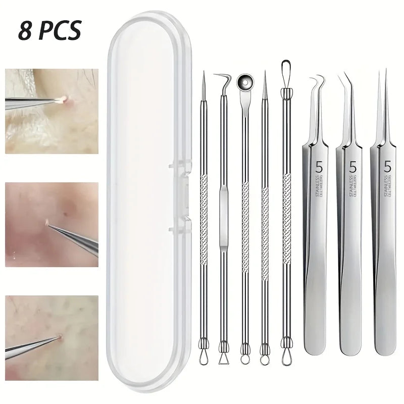 8-Piece Stainless Steel Blackhead & Blemish Extraction Kit
