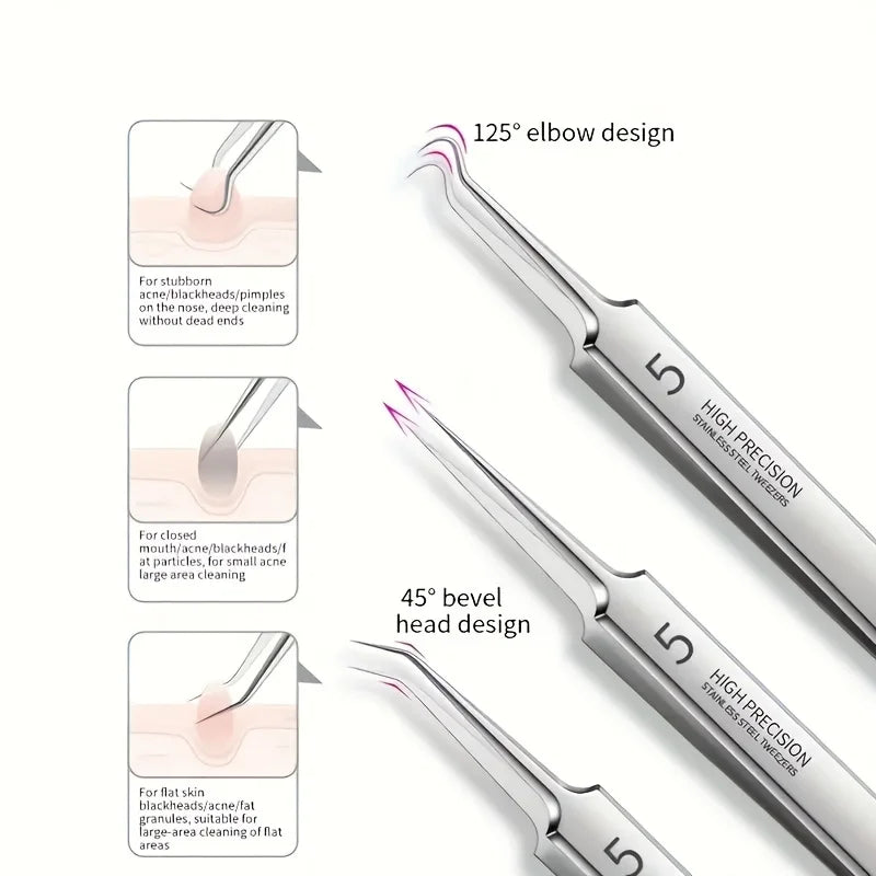 8-Piece Stainless Steel Blackhead & Blemish Extraction Kit